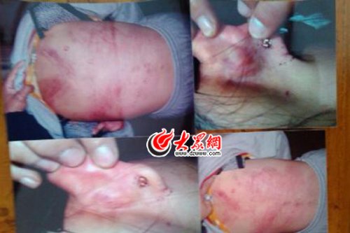 　山東藝術(shù)設(shè)計(jì)學(xué)院16歲女生宿舍內(nèi)被女同學(xué)暴打4小時(shí)。