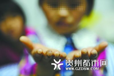 指尖被針扎得傷痕累累。