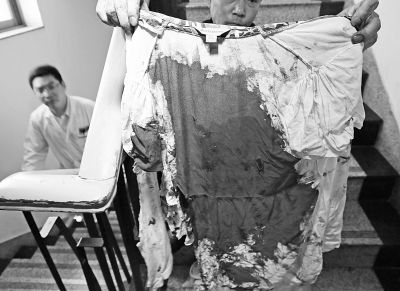 何女士的上衣被血浸透。記者楊濤攝