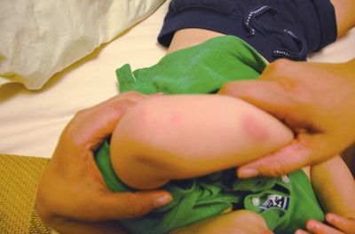 孩子身上有多處明顯傷痕。京華時(shí)報(bào)讀者供圖