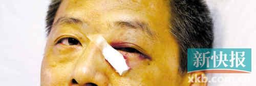 ■這起醫(yī)鬧事件，受傷的遠(yuǎn)遠(yuǎn)不只是熊旭明醫(yī)生的身體。