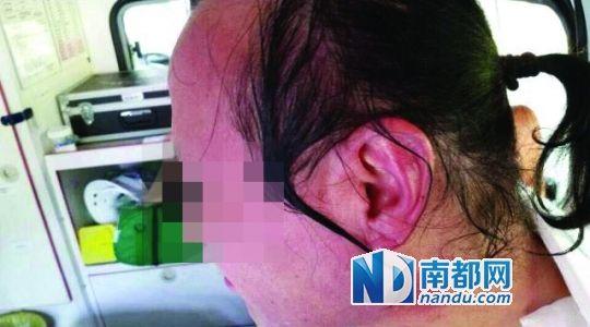 涉事教師遭熱水潑臉后的照片。