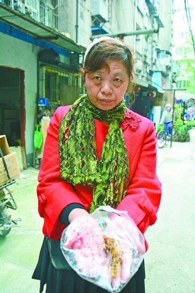 頭部受傷的黃女士展示兩根大魚刺。