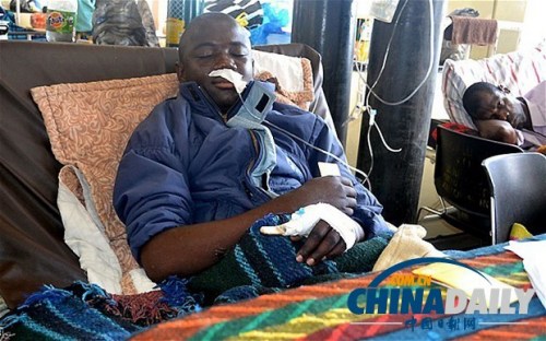 雖然已經(jīng)在醫(yī)院接受了近一個(gè)月的恢復(fù)治療，卡托卡的身體仍然非常虛弱。