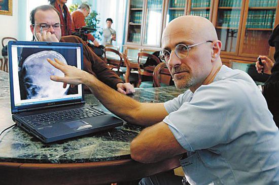 圖為卡納維洛醫(yī)生，不少人認(rèn)為他的想法非常瘋狂