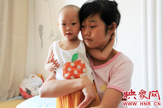 孩子和媽媽在一起，她的右眼已經(jīng)失明。