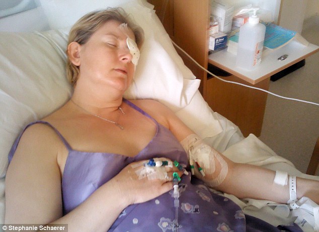 恐怖慎入！隱形眼鏡致英女子摘除眼球