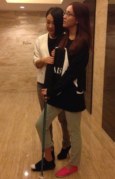 香港女星雨僑誤踢硬物腳趾骨裂錯失角色損失大