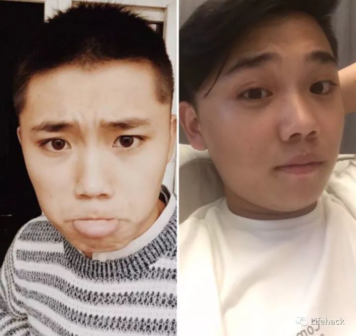 長胖20斤，臉型怎么變？這些例子看完扎心了！