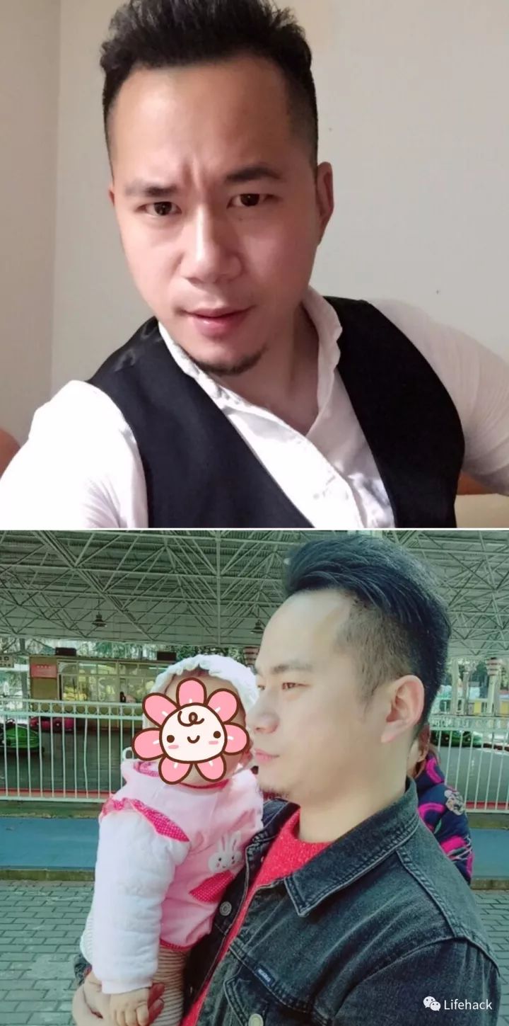 長胖20斤，臉型怎么變？這些例子看完扎心了！