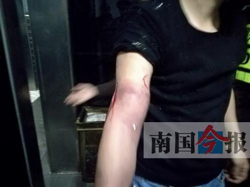 覃先生手臂被卡的部位受傷流血，所幸傷勢無大礙。 通訊員 王建民 攝