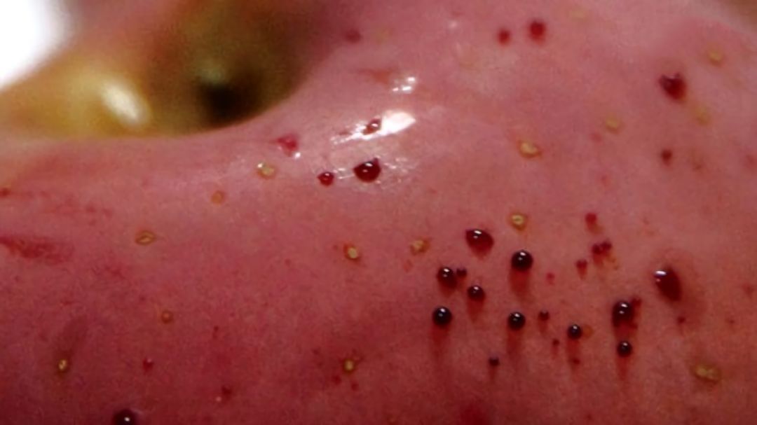 嚇懵！女子用熱水泡蘋果結(jié)果冒出血珠 咋回事？