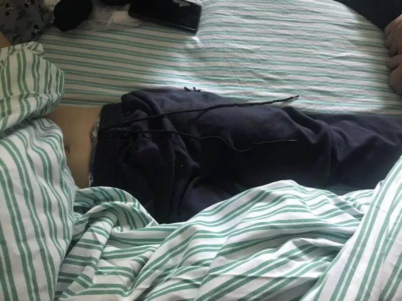 嚇哭！6歲男孩被夾斷手指 罪魁禍?zhǔn)拙故切７? oldsrc=