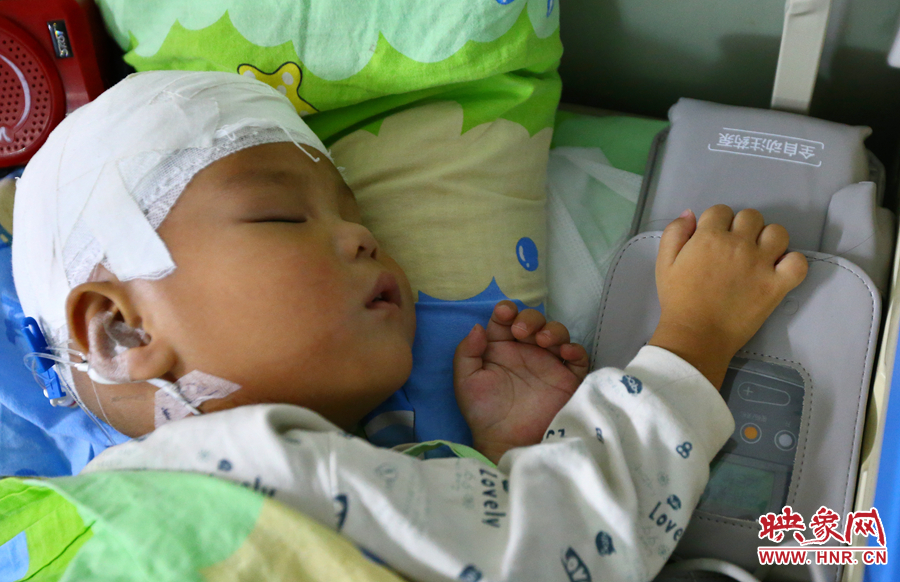 經(jīng)過手術(shù)，小龍病情已經(jīng)逐漸好轉(zhuǎn)，正在甜甜的熟睡