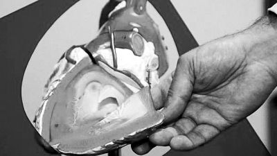 威廉斯領導的研究團隊已經(jīng)利用人體脂肪干細胞，成功3D打印出心臟血管和心臟瓣膜，待一顆心臟的所有部件打