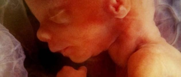 科學家研發(fā)可在子宮內(nèi)為胎兒做手術(shù)機器人