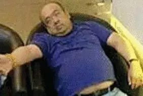 網(wǎng)傳金正男中毒后的照片。