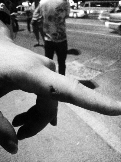 民警食指被咬傷。