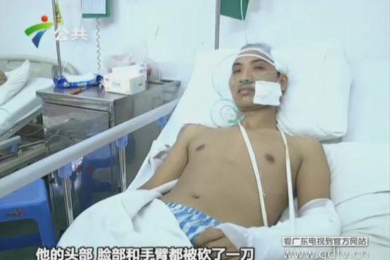 另一名傷者頭部、臉部和手臂都被砍了一刀。(視頻截圖)