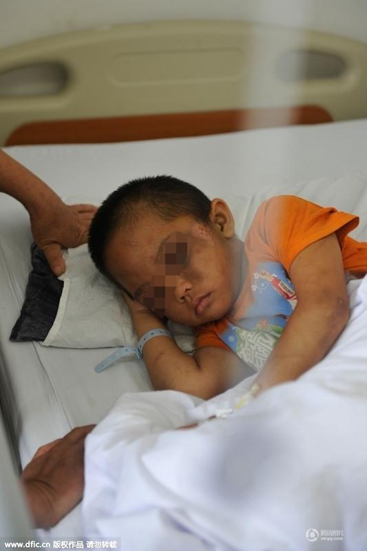 圖為全身傷痕累累的小進(jìn)。