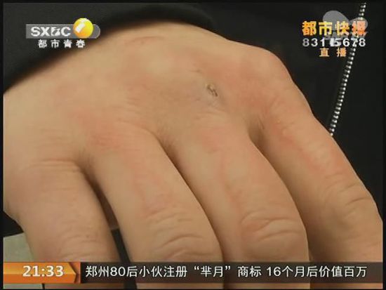 說(shuō)到這足療拔罐，估計(jì)大伙都不陌生，但是想起4號(hào)晚上的拔罐的經(jīng)歷，呂先生現(xiàn)在想起來(lái)，還心有余悸。