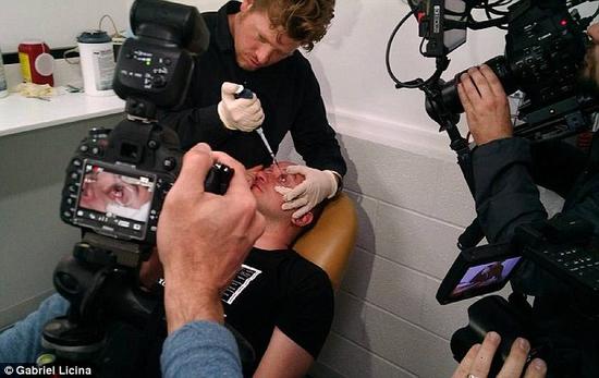 該實(shí)驗(yàn)是由加州一支名為“生物駭客”的實(shí)驗(yàn)團(tuán)隊(duì)開展的。他們使用了一種名為二氫卟吩e6（Ce6）的物質(zhì)的溶液。Ce6常見于深海魚體內(nèi)，有光敏特性，通常用于癌癥治療研究中。研究團(tuán)隊(duì)將Ce6與胰島素和鹽水混合起來，得到一種溶液，可以在低光照條件下提高人類的視力。