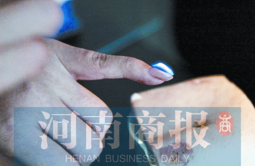 將指甲油涂在指甲上，靠近火焰時(shí)被引燃了