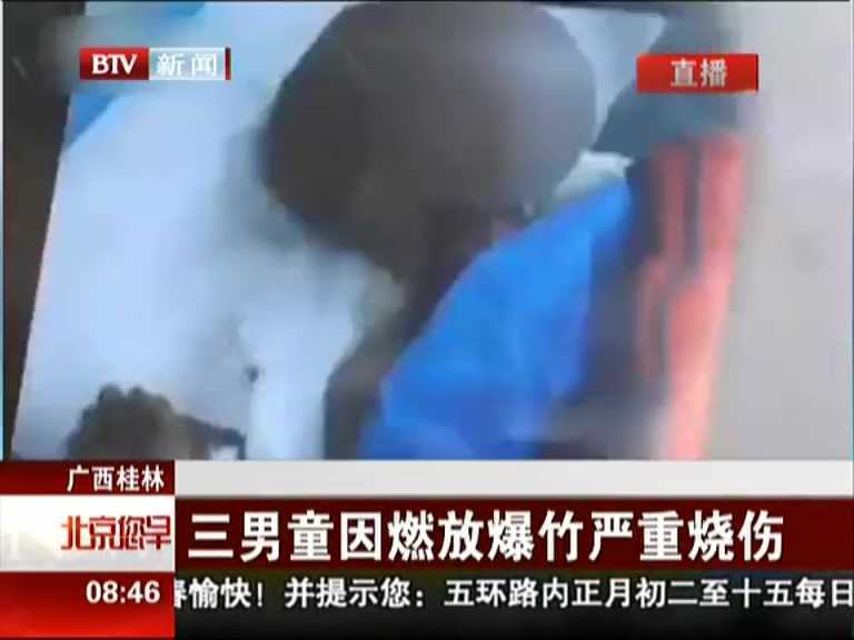 廣西桂林：三男童因燃放爆竹嚴重?zé)齻? title=