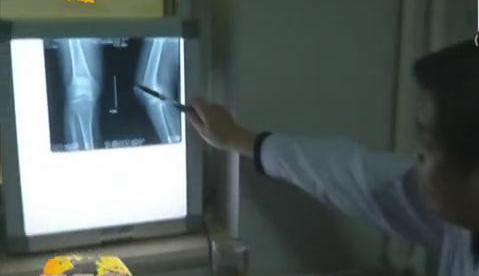 冷空氣來襲 如何預(yù)防老寒腿？