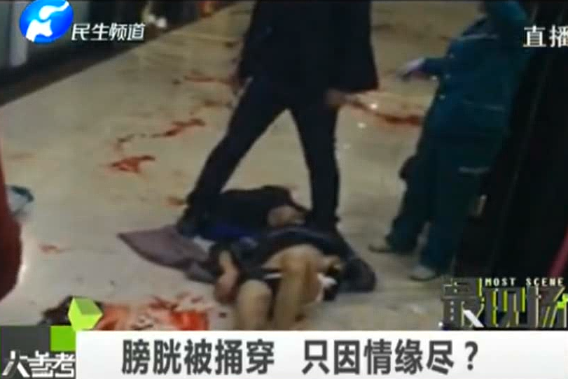 膀胱被捅穿 只因情緣盡？